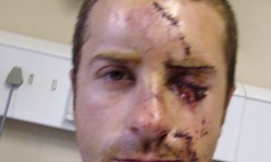 Burger aanvallers gevonnis